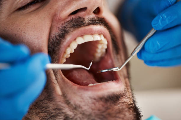 Best Knocked-Out Tooth Emergency  in Woodstock, GA